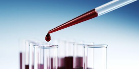 How Often Do You Need to Check Testosterone Levels? This Urologist’s Answer “Shocks” His Patients.