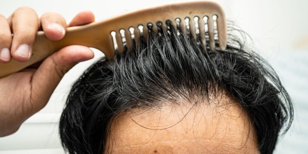 What Nutrients are Important for Hair Growth?