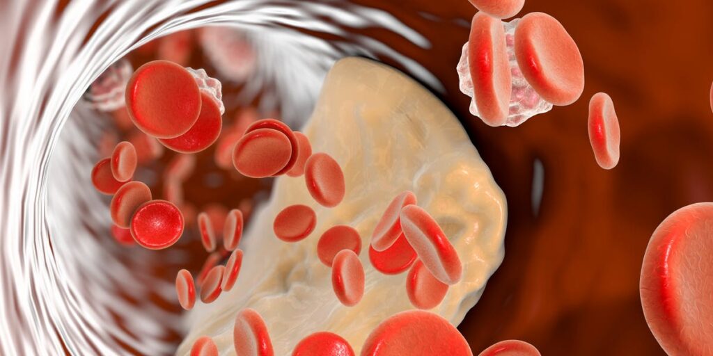 The Cheap, Underrated Cholesterol Test Your Cardiologist Wants You to Take