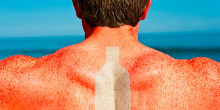 Why Anti-Sunscreen Claims Are Spreading Online