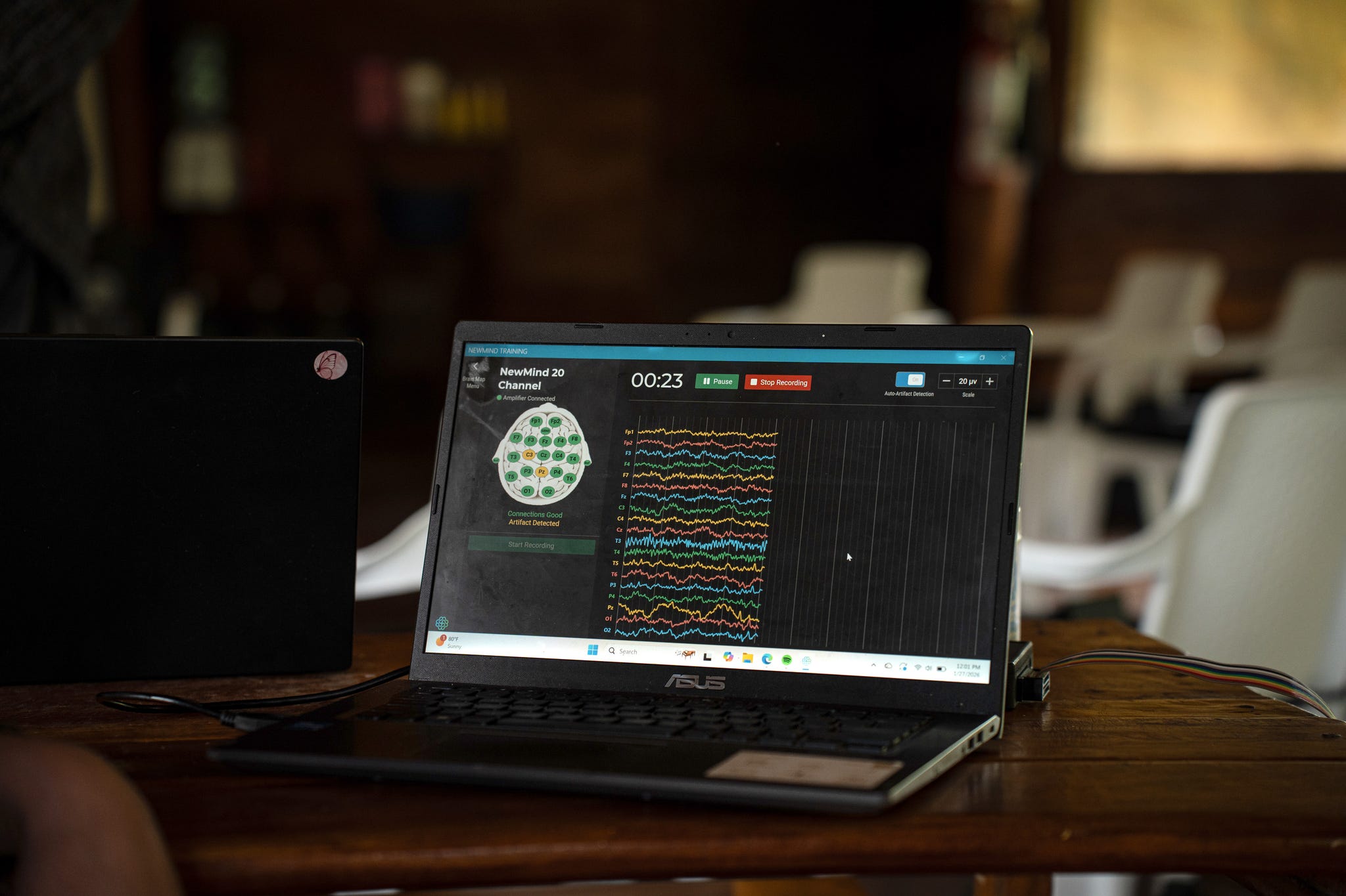 Laptop displaying neurofeedback software interface with waveform data and recording options.