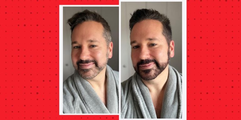 Pros, Cons, Does it Look Natural?